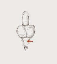 muscles potentiels et leur tension pour augmenter le potentiel